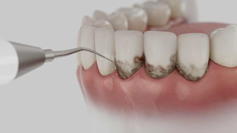 Reliable Wisdom Tooth Removal contractor in Talbot County County, MD by Dentist Open Now
